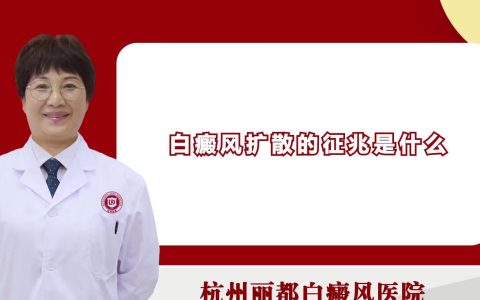 白癜风扩散后的症状表现是什么？白癜风扩散这几种症状最明显