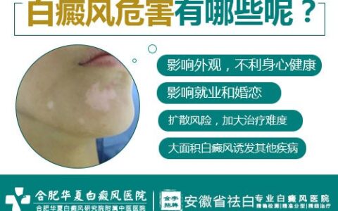 白癜风危害有哪些方面