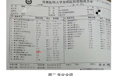 蔡磊公布渐冻症诊断报告 5月住进ICU一度考虑气切-渐冻症医生是谁